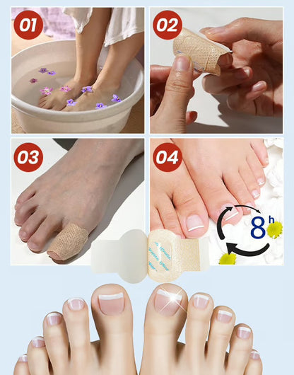Svampdödande nagelklistermärken