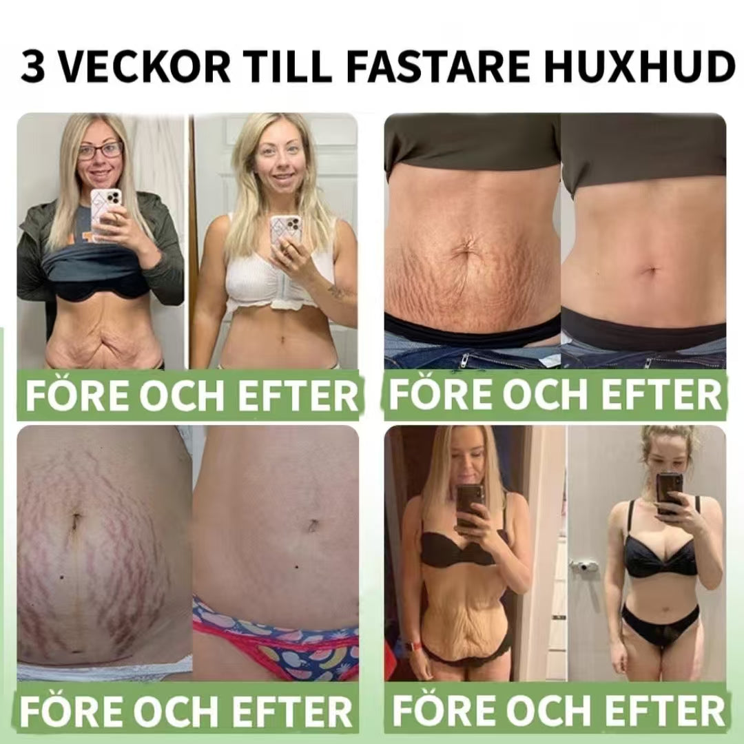 Kollagenkräm
