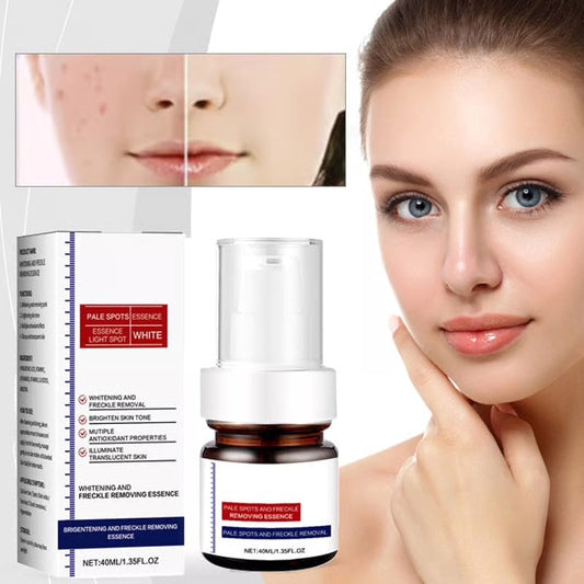 C-vitamin ljusande fräknar ansiktskräm